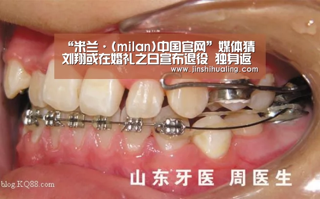 米兰·(milan)中国官网